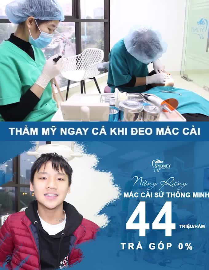 MẮC CÀI SỨ THÔNG MINH