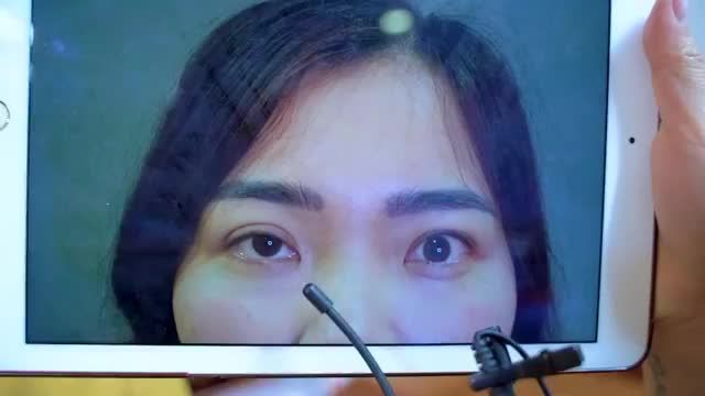 Mắt lỗi hỏng cường cơ nâng mi gây trợn, nếp mí to nhỏ không đều sau phẫu thuật cắt mí sẽ xử lý như thế nào? Theo dõi video ngay bạn nhé