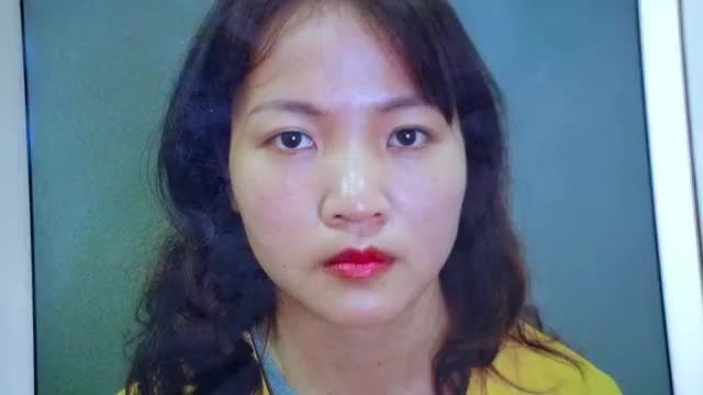 Mắt rạng rỡ, trẻ sang tự nhiên chỉ sau 45 phút thực hiện Cắt mí tại Dr.Hải Lê
