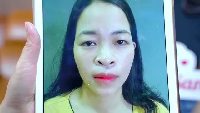 Mắt sụp mí u buồn khắc phục như thế nào? Theo dõi video Cắt mí Mk để có thêm động lực bạn nhé