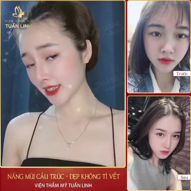 MỘT CHIẾC MŨI XINH CHO CẢ NĂM TÀI LỘC.