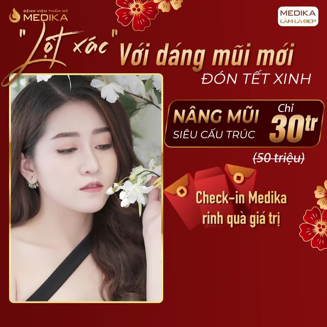 MỘT DÁNG MŨI XINH CHO CẢ NĂM THẬT CHÓI LÓA