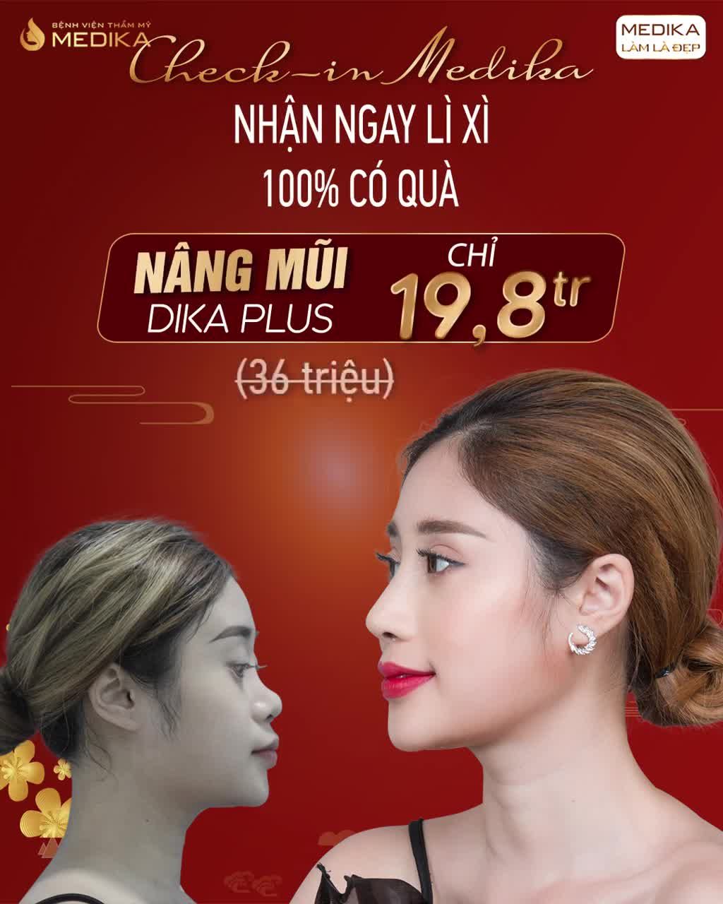 MŨI CAO XINH VẠN NGƯỜI MÊ