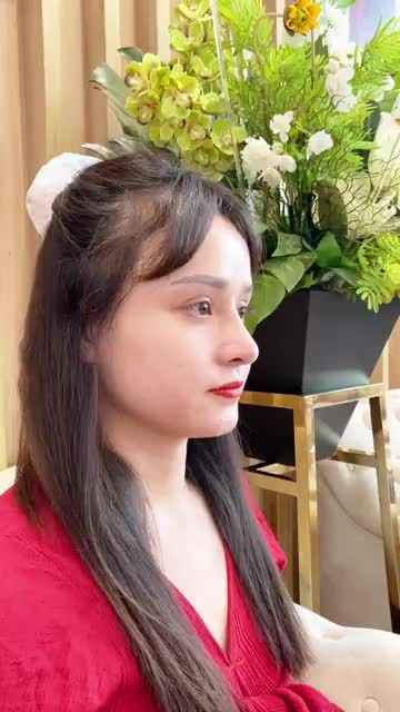 MŨI CẤU TRÚC SIÊU XINH SAU 3 THÁNG