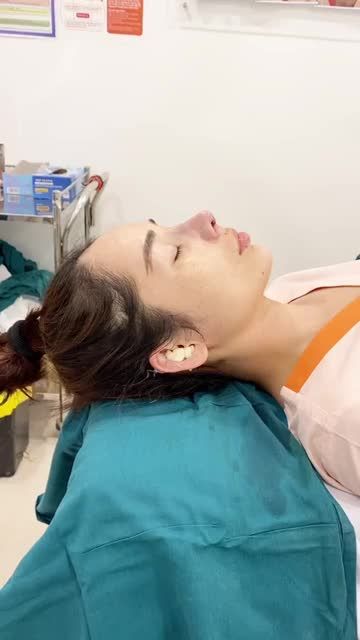 MŨI CẤU TRÚC SURGIFORM