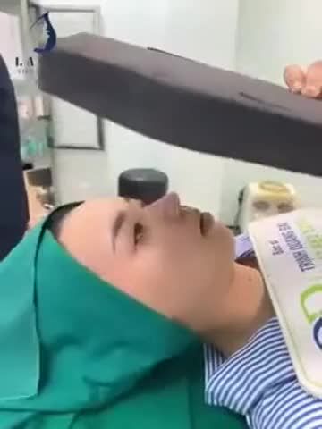 Mũi cấu trúc xử lý nền xương mài gồ KẾT QUẢ NGAY SAU PHẪU THUẬT mời cả nhà cùng ngắm ạ.