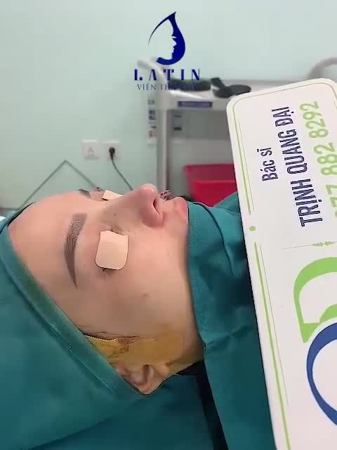 Mũi của bạn gái bẩm sinh đã có nền xương hơi lệch vẹo về bên phải, sống mũi thấp ngắn, khuyết cánh, đầu mũi hếch.