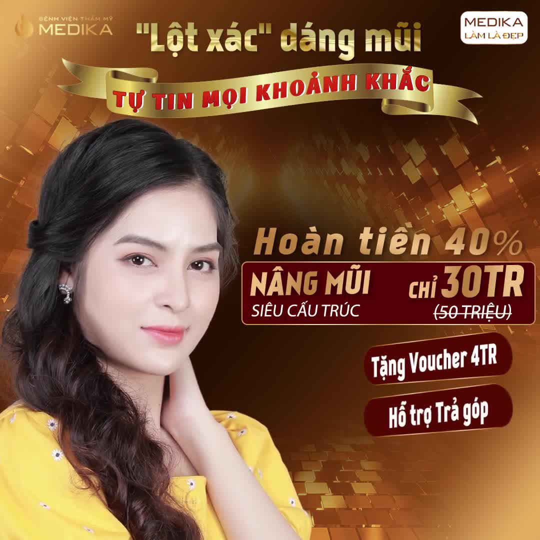 MŨI ĐẸP HƠN, NHAN SẮC THĂNG HẠNG HƠN