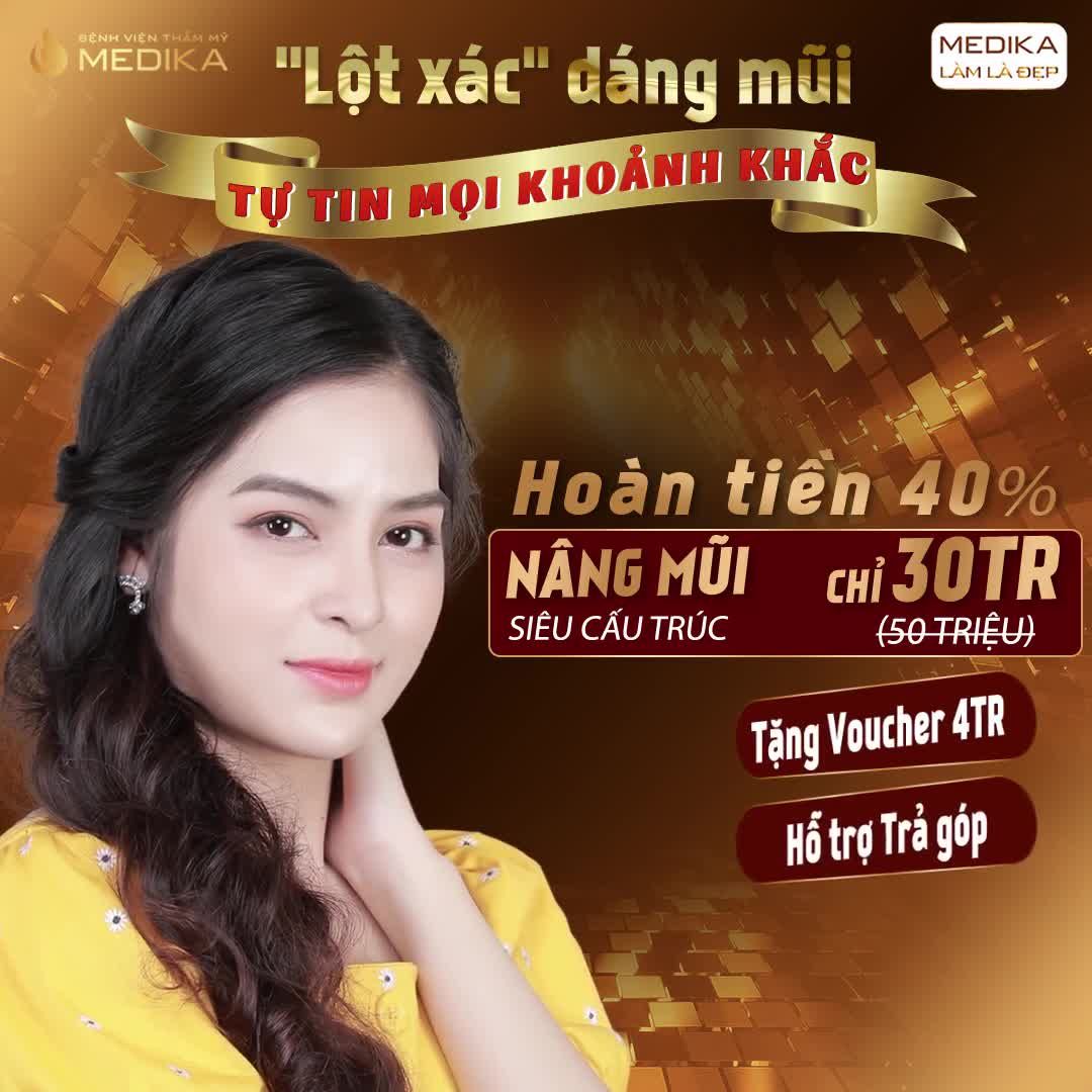 MŨI ĐẸP HƠN, NHAN SẮC THĂNG HẠNG HƠN