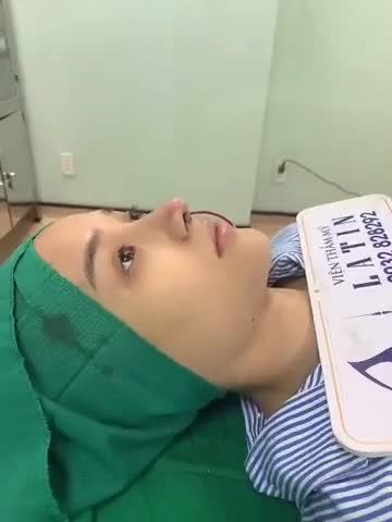 MŨI ĐẸP MÊ LY, KHỞI ĐẦU NHƯ Ý
