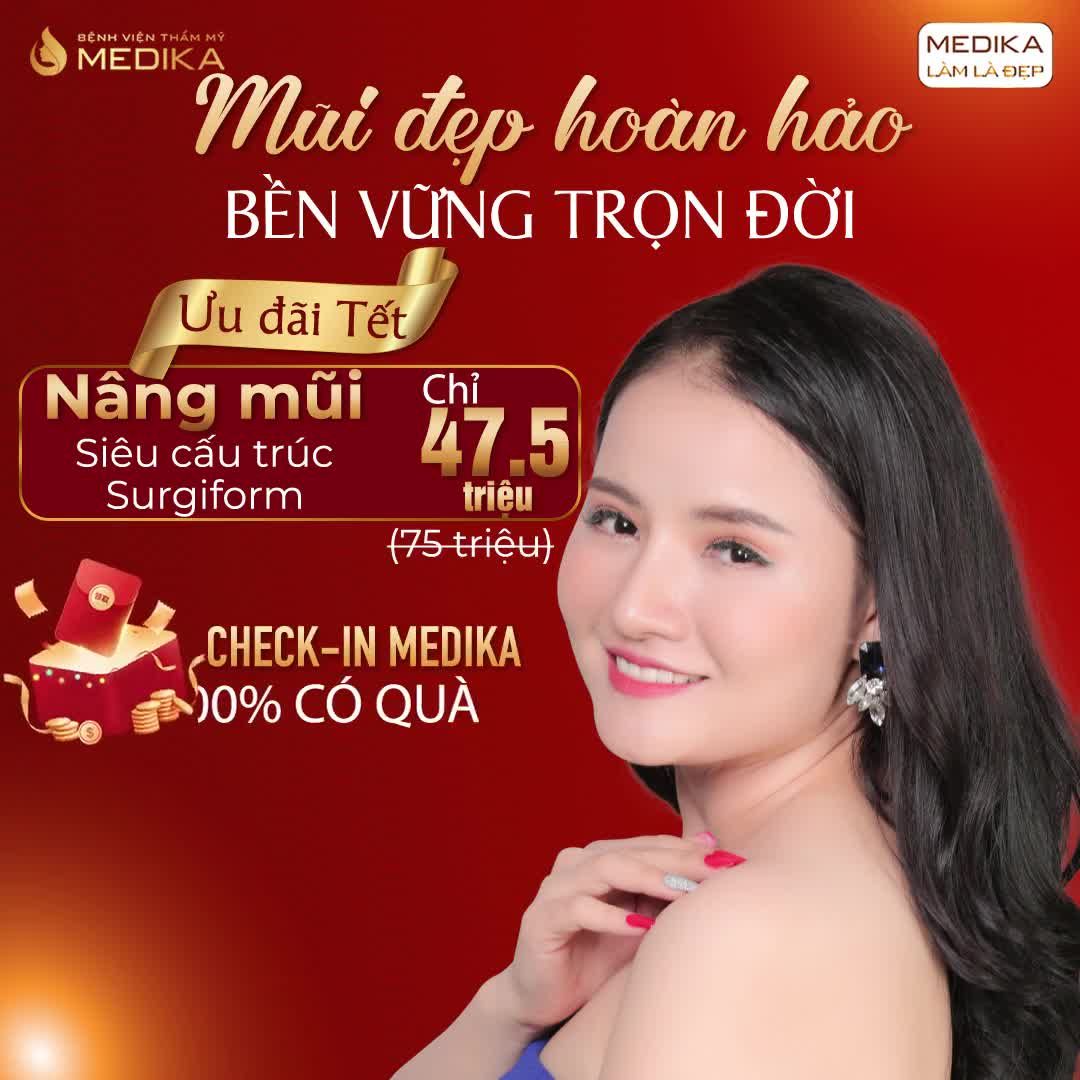 MŨI ĐẸP TOÀN DIỆN - CẢ NĂM RẠNG NGỜI