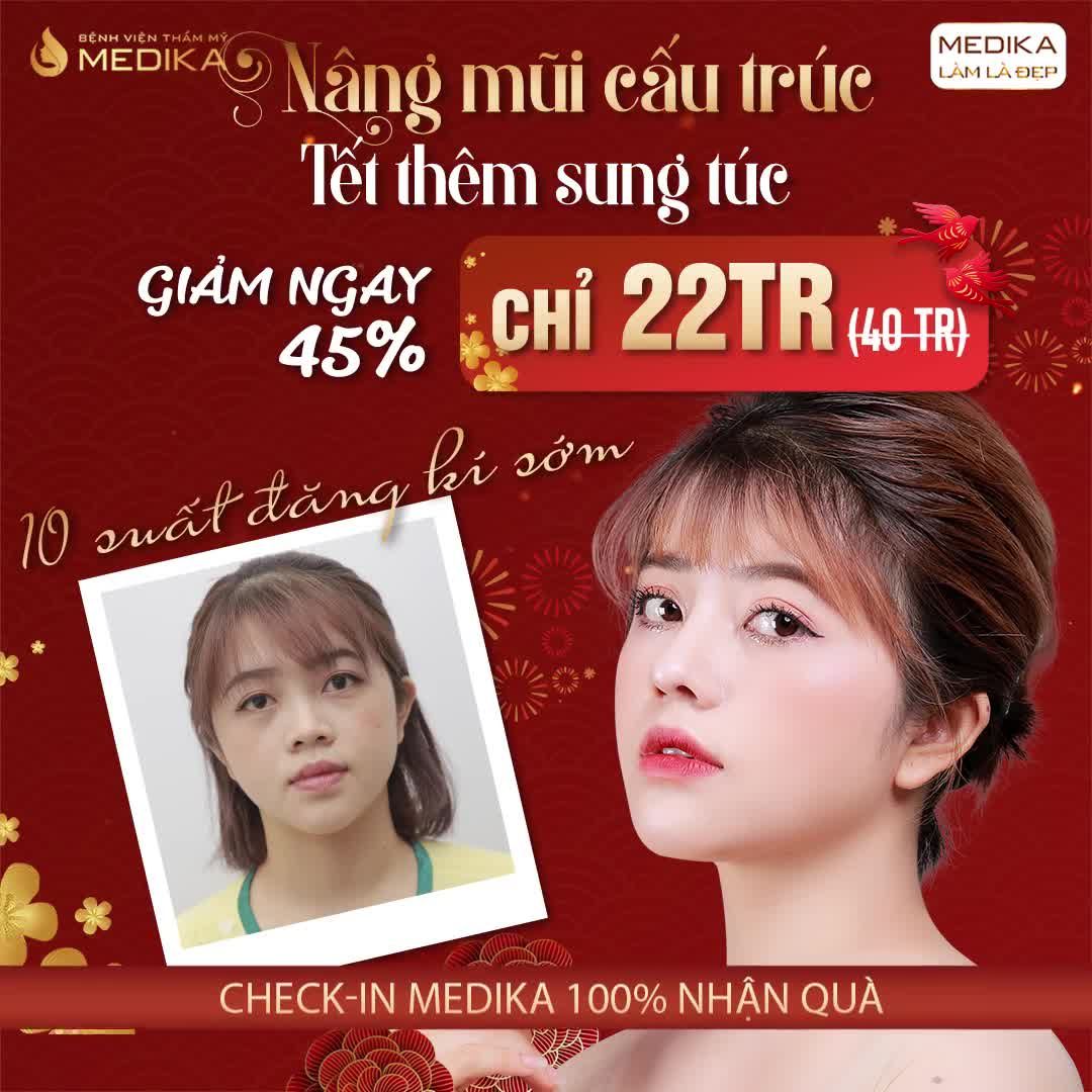 Mũi thấp tẹt/ đầu mũi ngắn hếch  HÃY ĐẾN MEDIKA ĐỂ KIỂM CHỨNG HIỆU QUẢ NÂNG MŨI