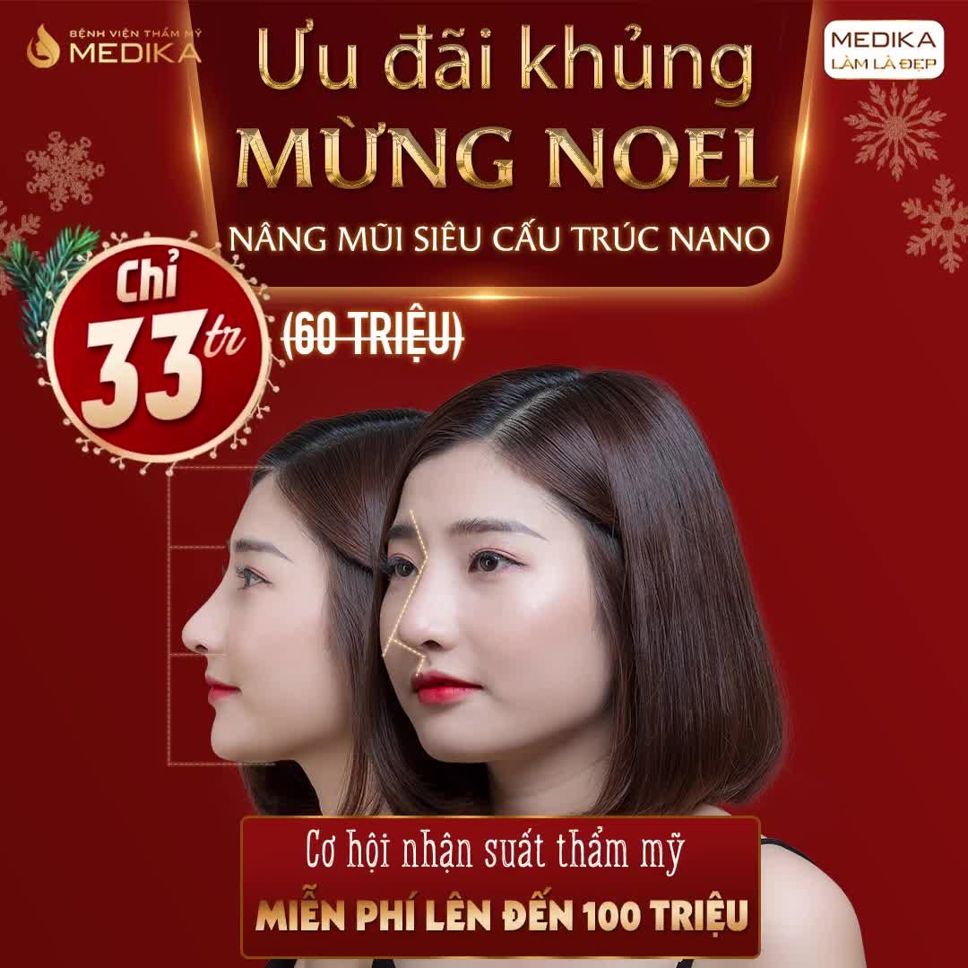 MŨI THẤP TẸT KÉM XINH CHỈ CÒN LÀ QUÁ KHỨ NÂNG MŨI SIÊU CẤU TRÚC NANO SỞ HỮU MŨI ĐẸP HOÀN HẢO