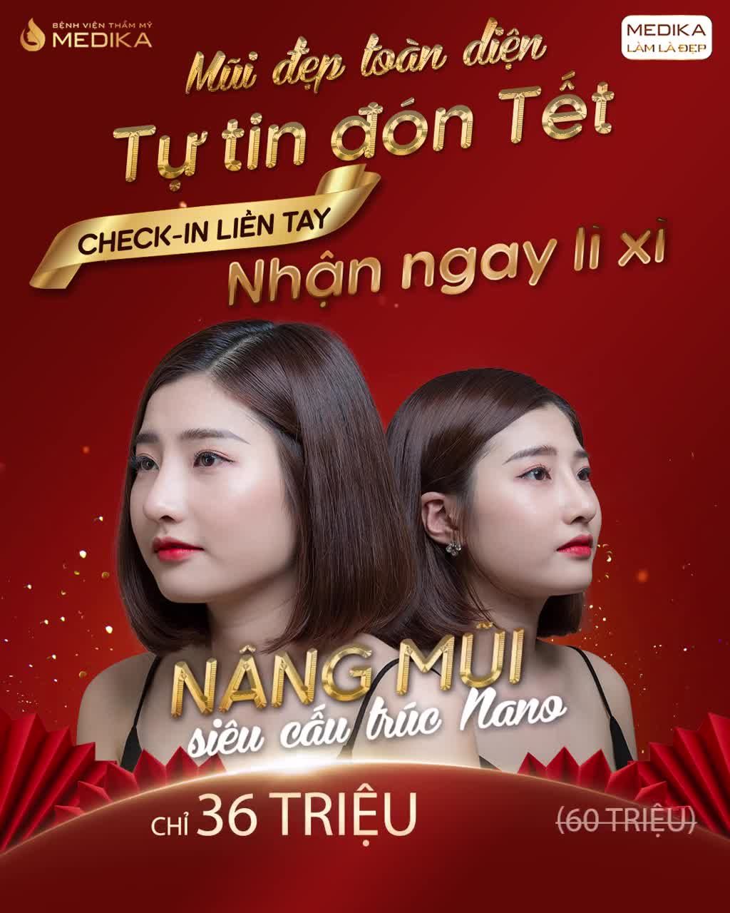 MUỐN MŨI CAO TÂY NHƯNG VẪN ĐẢM BẢO AN TOÀN THÌ SAO?