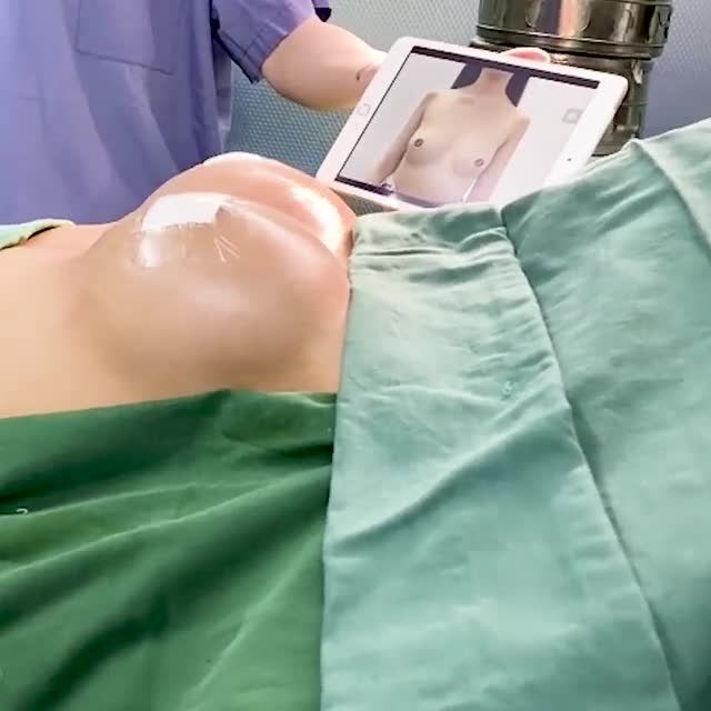 NÂNG CẤP V1 GẦN NHƯ "KHÔNG CHẢY M,ÁU