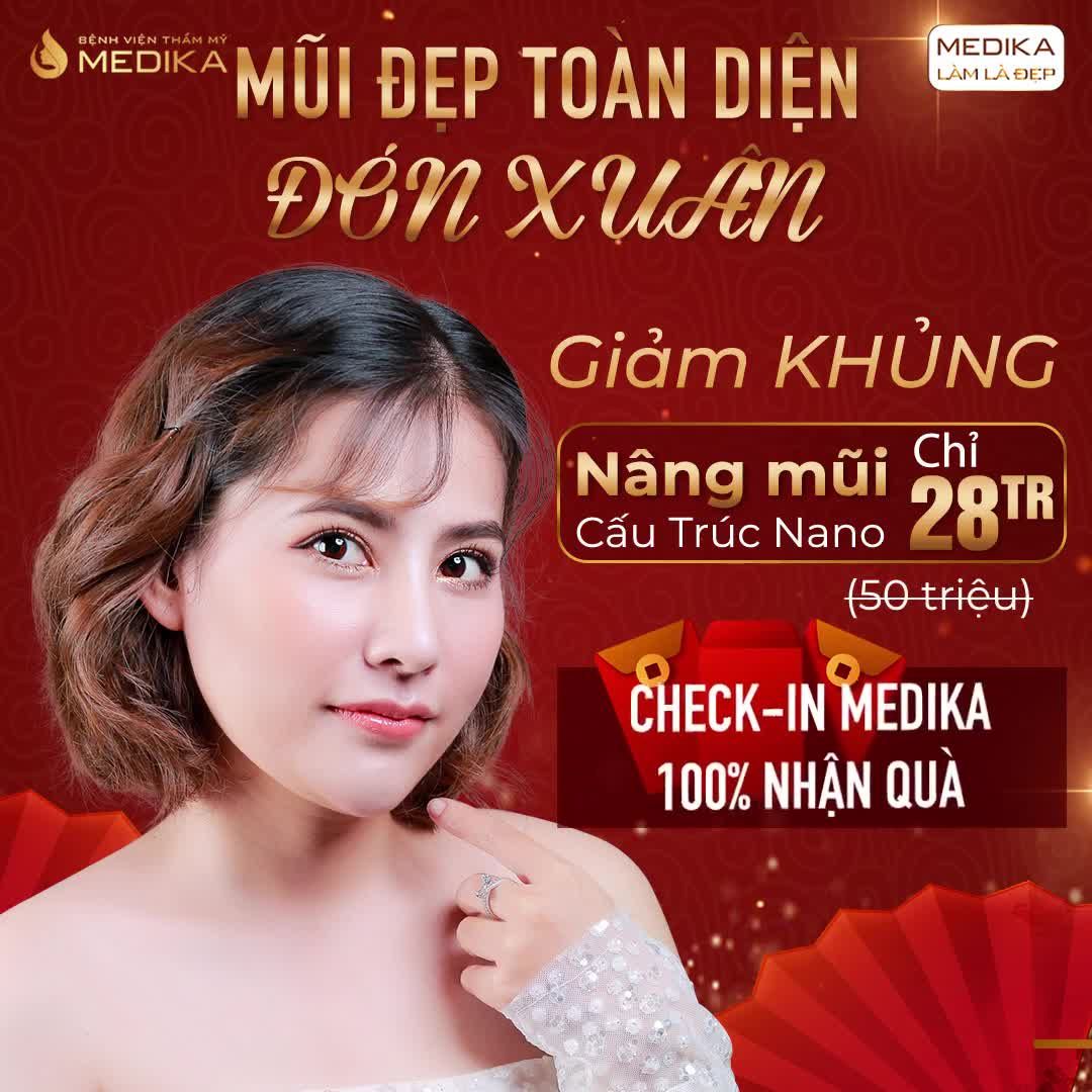 NÂNG MŨI CẤU TRÚC NANO sụn chính hãng 100% - mũi bền đẹp trọn đời