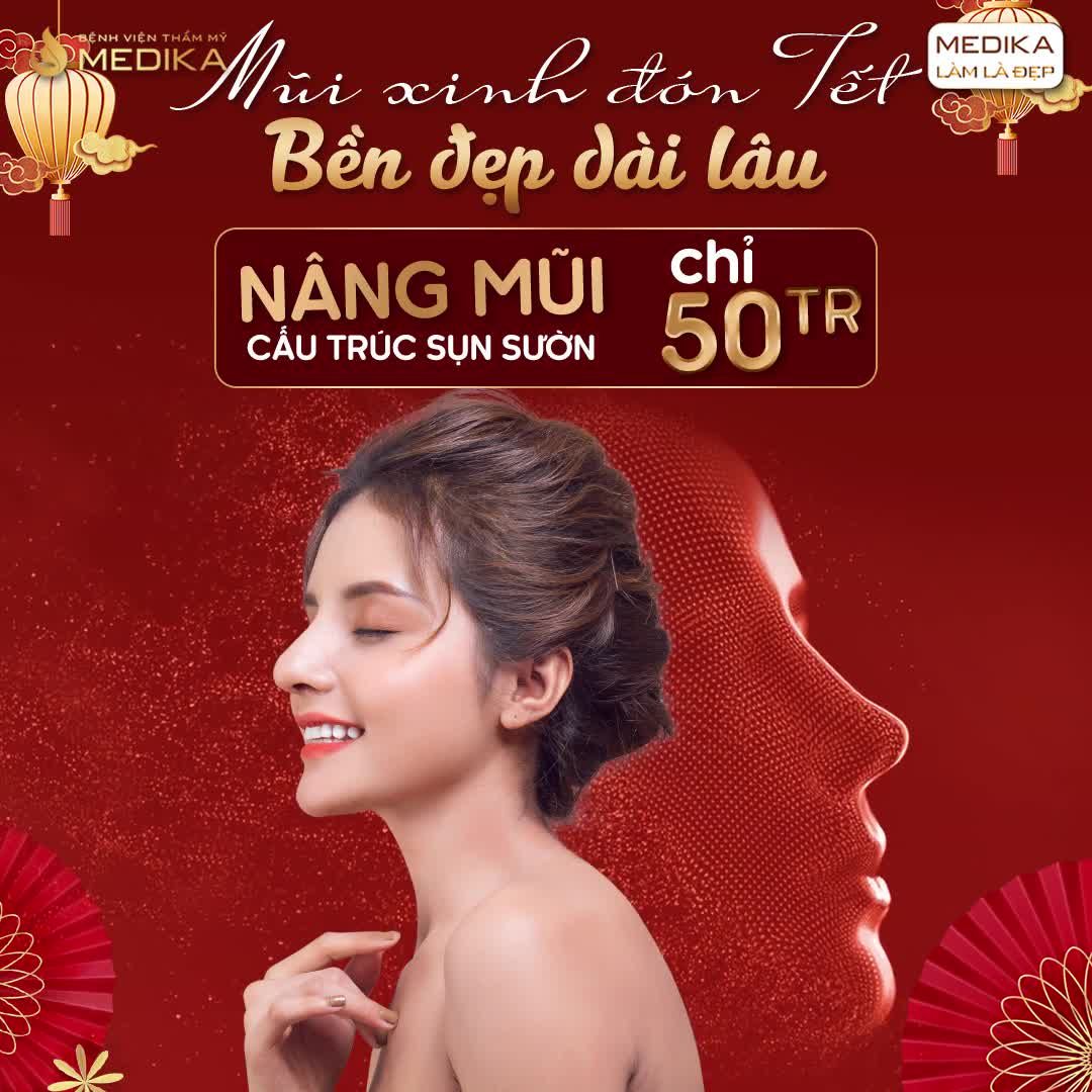 NÂNG MŨI CẤU TRÚC SỤN SƯỜN "ĐỈNH CỦA CHÓP"