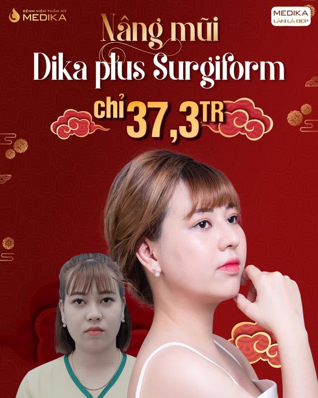 NÂNG MŨI DIKA PLUS SURGIFORM ĐẸP LÂU DÀI