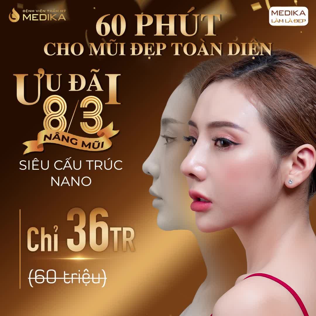 NÂNG MŨI SIÊU CẤU TRÚC NANO HÔM NAY, TẶNG NGAY 24 TRIỆU