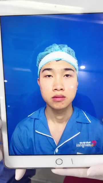 NÂNG MŨI xong hoá HOT BOY luôn!