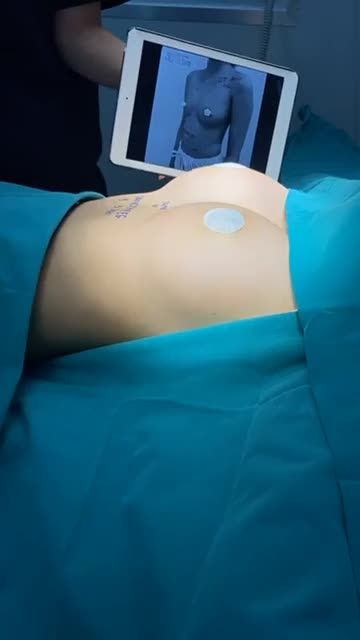 NANOCHIP EG LỰA CHỌN HOÀN HẢO CHO VÒNG 1 CĂNG TRÒN, MỀM MẠI