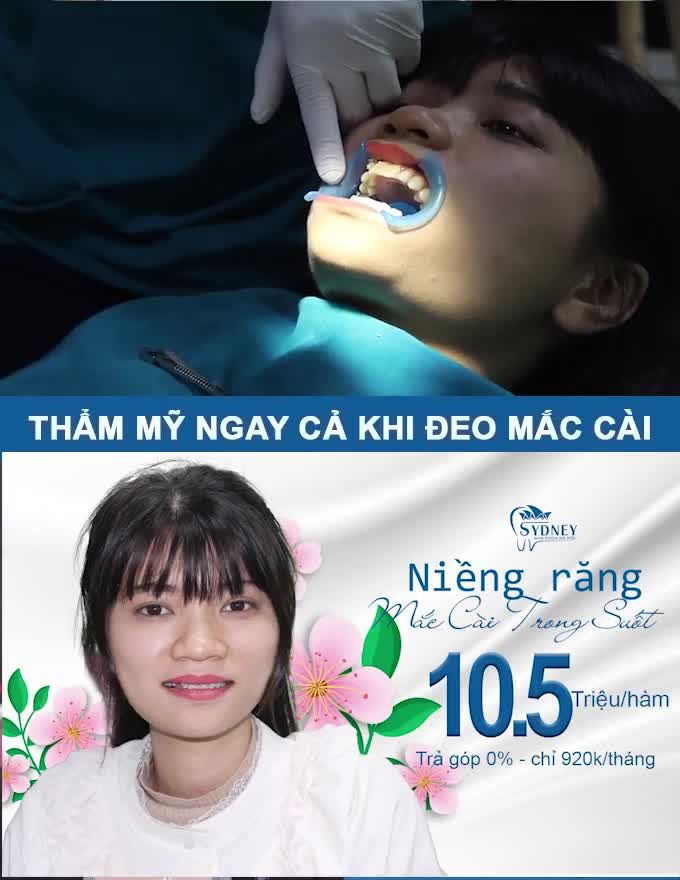 NÊN CHỌN MẮC CÀI SỨ HAY MẮC CÀI PHA LÊ