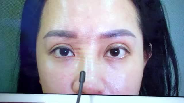Nếu bạn chưa tìm được địa chỉ uy tín sửa lại Mí hỏng liên hệ ngay Dr.Hải Lê để được tư vấn và có phác đồ điều trị nhé
