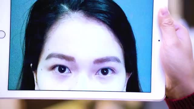 Nếu bạn đang có ý định thực hiện Cắt mí tại Dr.Hải Lê bạn không nên bỏ qua video này