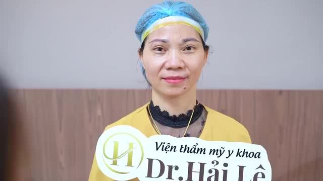 Nếu bạn đang gặp phải tình trạng Sụp mí, da dư thừa lão hóa, mắt mỏi, tâm nhìn che khuất  Đến ngay Dr.Hải Lê để có phương pháp khắc phục bạn nhé