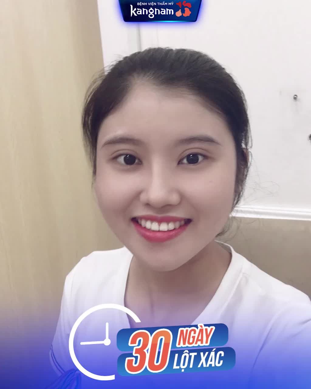 Ngạc nhiên chưa! Hàm vuông 90 độ vẫn sửa được nhé!