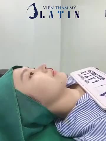 NGẮM MŨI ĐẸP MÊ LY NGAY TRONG PHÒNG PHẪU THUẬT