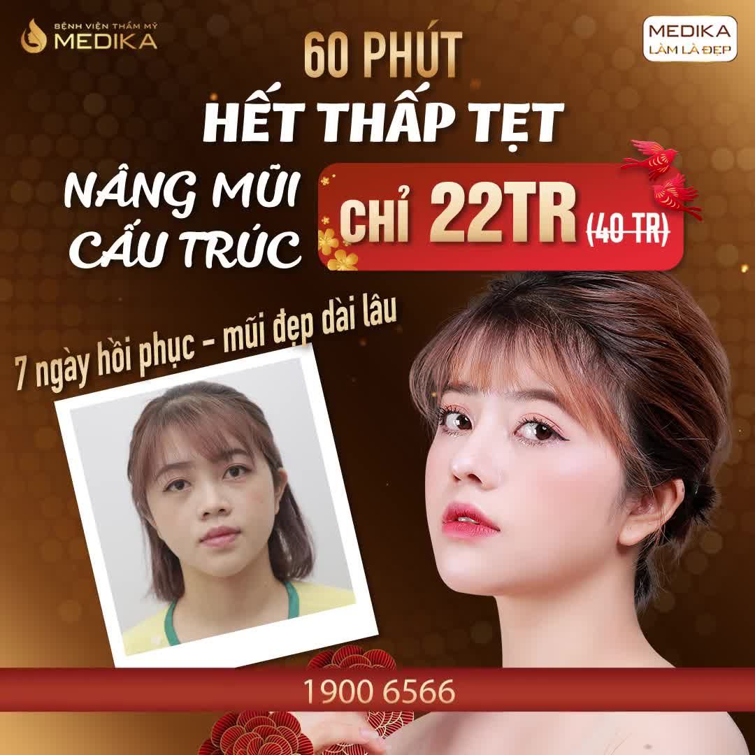 NGỌC YẾN XINH NHƯ HOTGIRL SAU NÂNG MŨI CẤU TRÚC