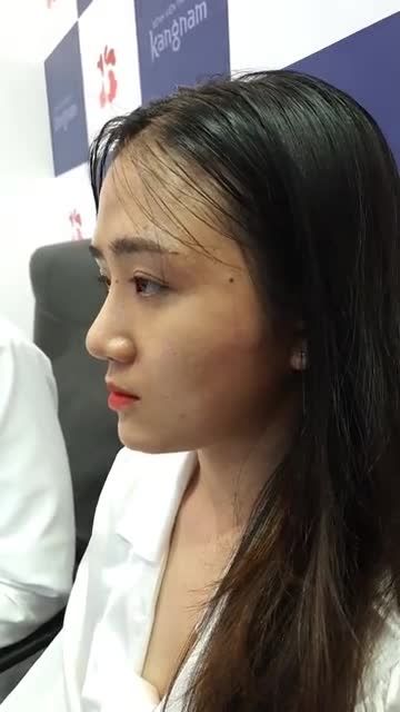 Nhìn là ưng mà ngắm là say với dáng mũi của khách nhà Kangnam Dáng Sline mềm mại, không lộ dấu vết đã thẩm mỹ