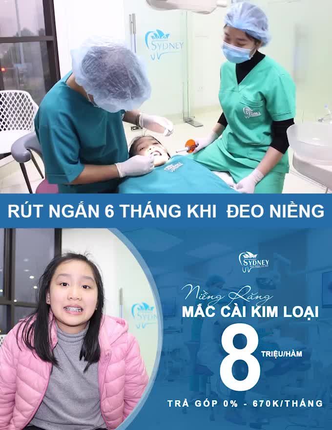 NIỀNG RĂNG MẮC CÀI KIM LOẠI CÓ MẤT NHIỀU CHI PHÍ KHÔNG