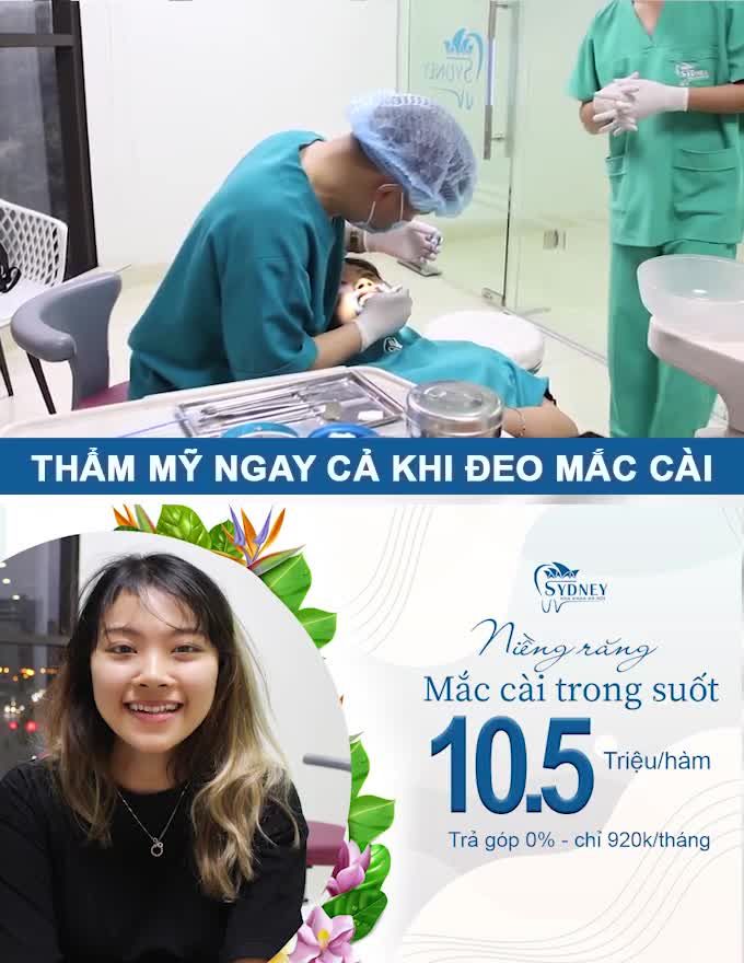 NIỀNG RĂNG MẮC CÀI PHA LÊ CÓ TỐT KHÔNG