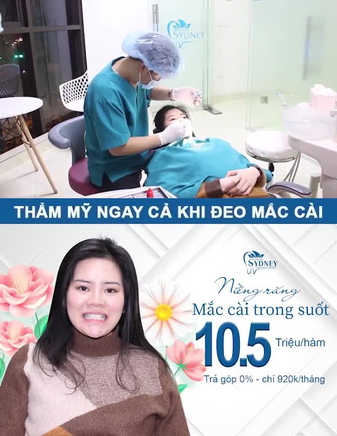 NIỀNG RĂNG MẮC CÀI PHA LÊ