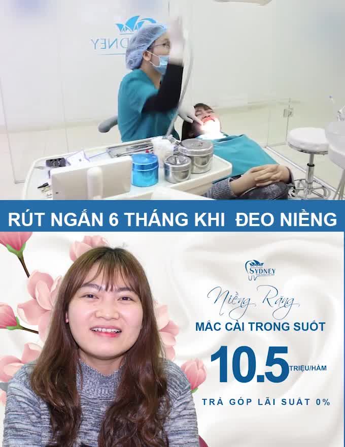 NIỀNG RĂNG MẮC CÀI TRONG SUỐT THẨM MĨ CAO