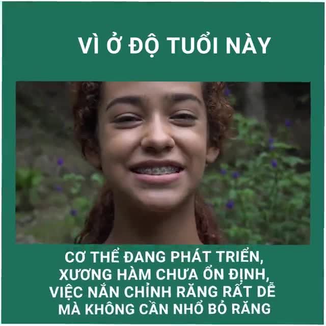 Niềng răng sớm là cách thông minh nhất để có được khớp răng hoàn chỉnh cùng khuôn mặt đẹp
