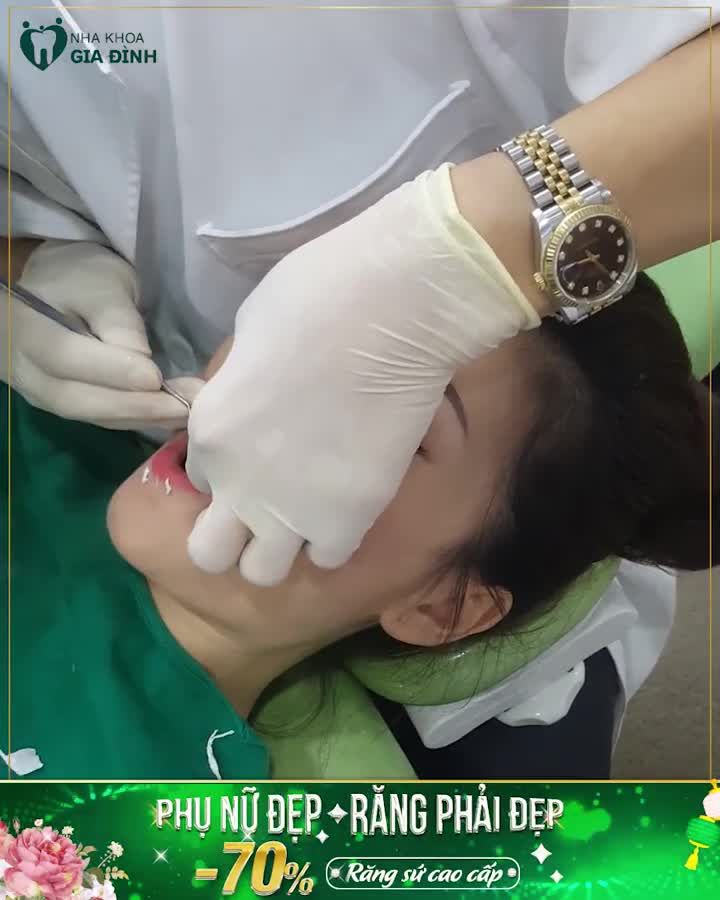 PHỤ NỮ ĐẸP – RĂNG PHẢI ĐẸP