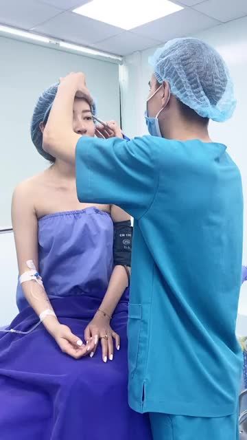 Quá trình đo vẽ trước khi thực hiện Cấy mỡ mặt Stem Cells