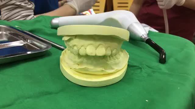 Quá trình gắn mắc cài niềng răng cho bạn Linh.