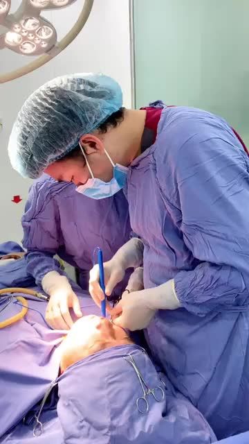 Quy trình BÓC MỠ MÁ - THON GỌN MẶT tại BVTM KANGNAM