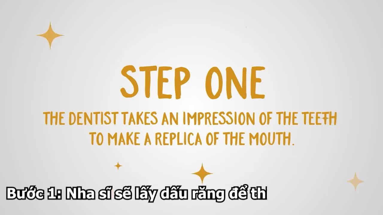 QUY TRÌNH CHẾ TÁC RĂNG SỨ THẨM MỸ TRONG NHA KHOA