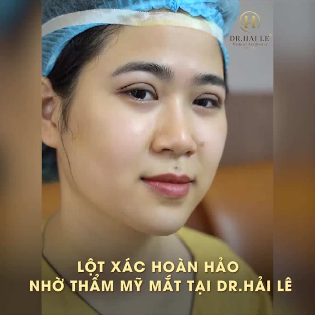 Sức mạnh CẮT MÍ thay diện mạo chỉ sau 40 PHÚT đã làm hàng nghìn khách hàng tại Dr.Hải Lê cực kỳ kinh ngạc!