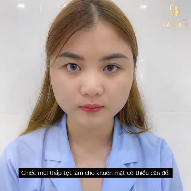 TÁI HIỆN HÀNH TRÌNH " LỘT XÁC" DÁNG MŨI THÀNH CÔNG HƠN 100% CỦA CÔ NÀNG HOTGIRL PHƯƠNG THANH VÀ NHỮNG CHIA SẺ CỦA CÔ ẤY.