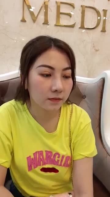 TÁI KHÁM SAU 3 THÁNG NÂNG MŨI SIÊU CẤU TRÚC NANO