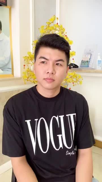 TÁI KHÁM SAU 3 THÁNG NÂNG MŨI SIÊU CẤU TRÚC TẠI MEDIKA