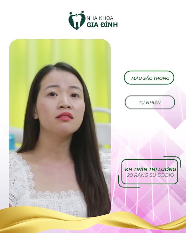 THẨM MỸ RĂNG SỨ - GIẢI PHÁP HOÀN HẢO CHO NỤ CƯỜI ĐẸP