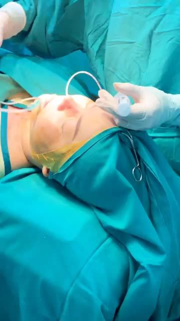 THÀNH QUẢ SAU 60 PHÚT NÂNG MŨI CẤU TRÚC