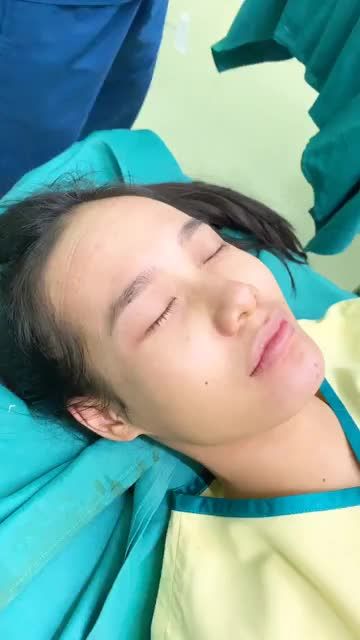 THÀNH QUẢ SAU ĐỘN CẰM V-LINE MỸ